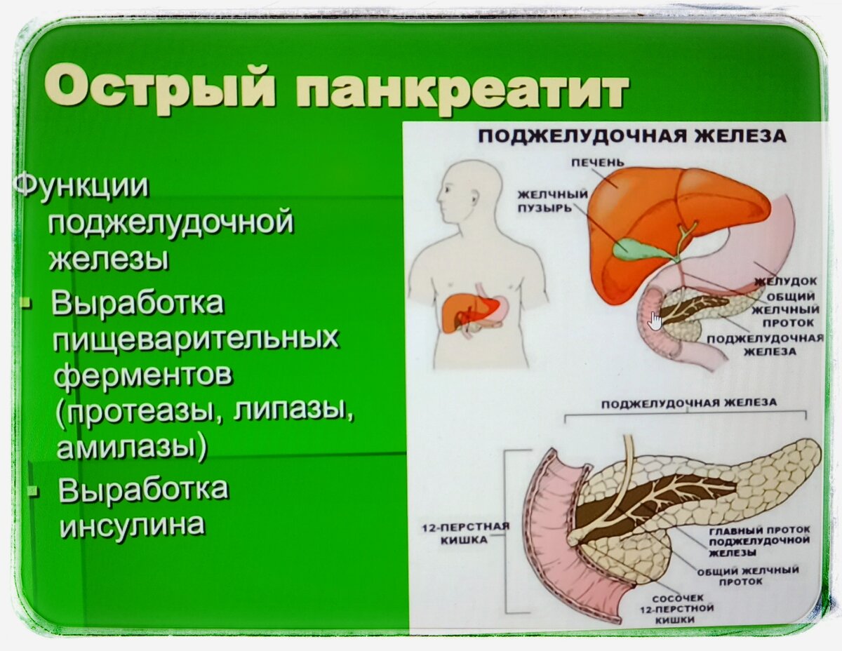 Поджелудочная железа где находится как лечить. Болезнь пищеварительной системы панкреатит. Лекарства воспаление поджелудочной железы панкреатит.