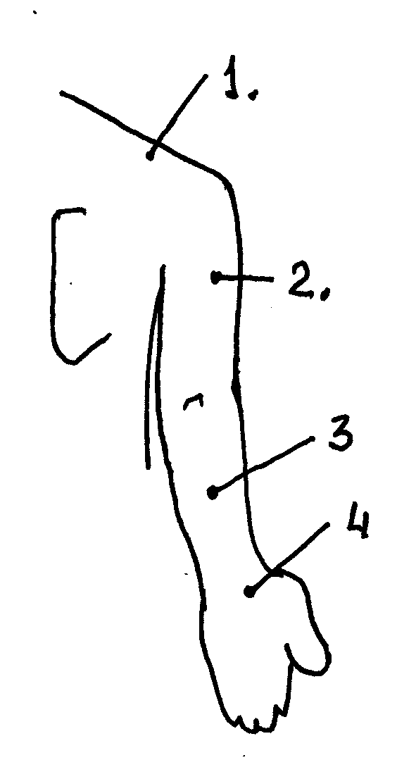 Из книги В.Г. Соломатов "Межпозвонковая грыжа от "А" до "Я"