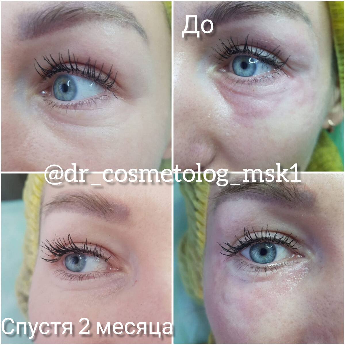 От 1 процедуры