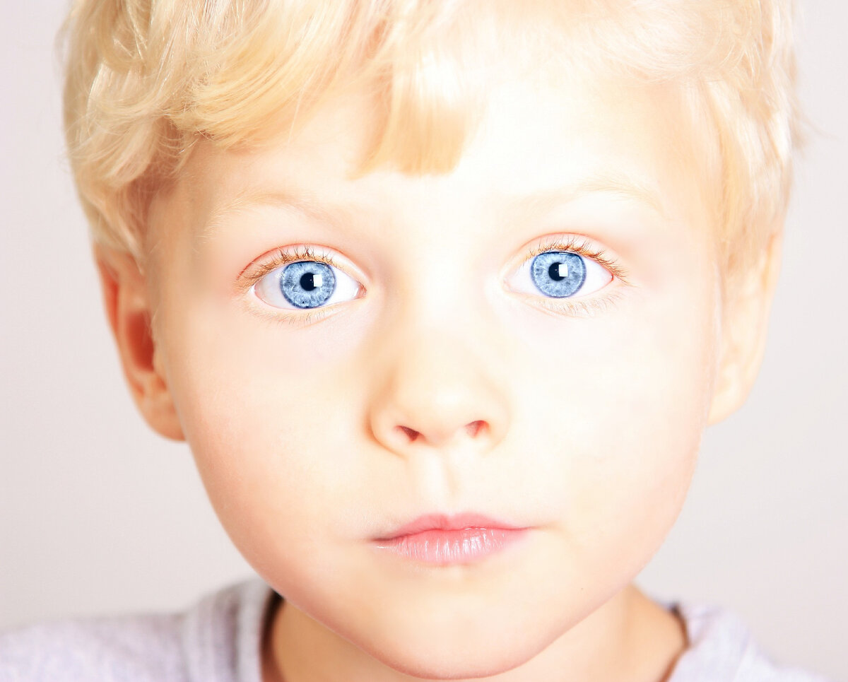 глаза картинка для детей. нистагм, страбизм. косоглазие экзотропия. косоглазие у детей. ребенок глазами смотрит в сторону.