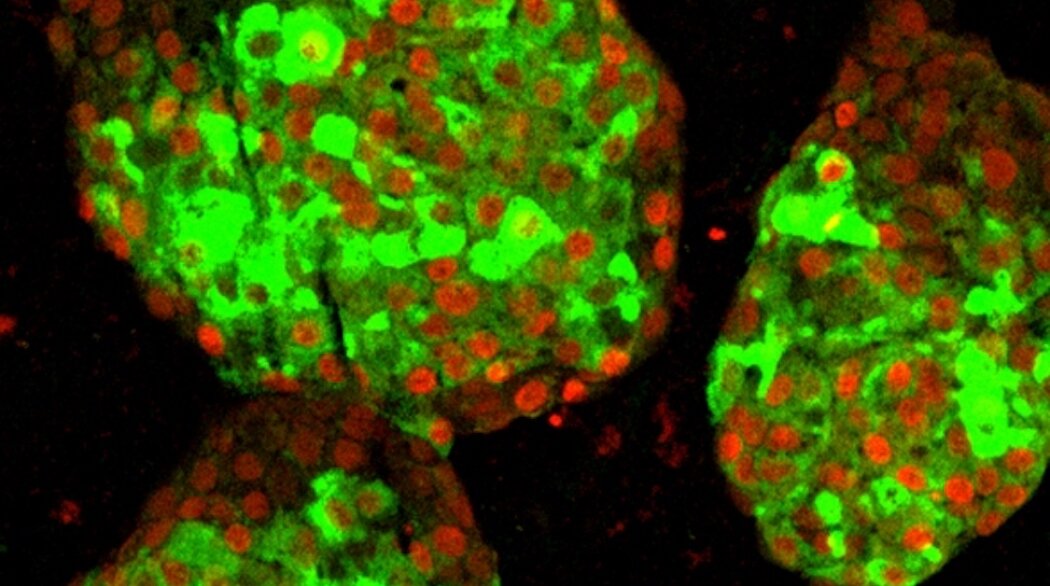  (фото: Hebrok Lab / Ucsf)