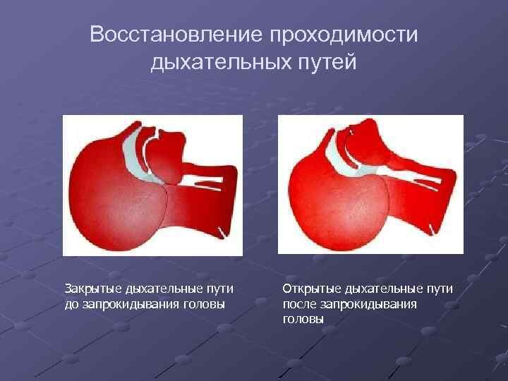 Обыкновенный героизм Как спортсмены спасают людям жизнь: Летние виды: Спорт: insidersexx.ru