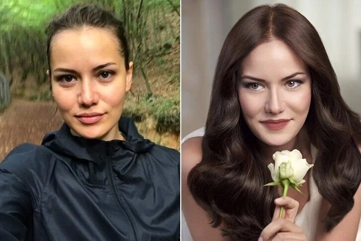 Александрова до и после пластики Как выглядят турецкие актрисы без макияжа и фотошопа? İstanbul’ские заметки Дзен