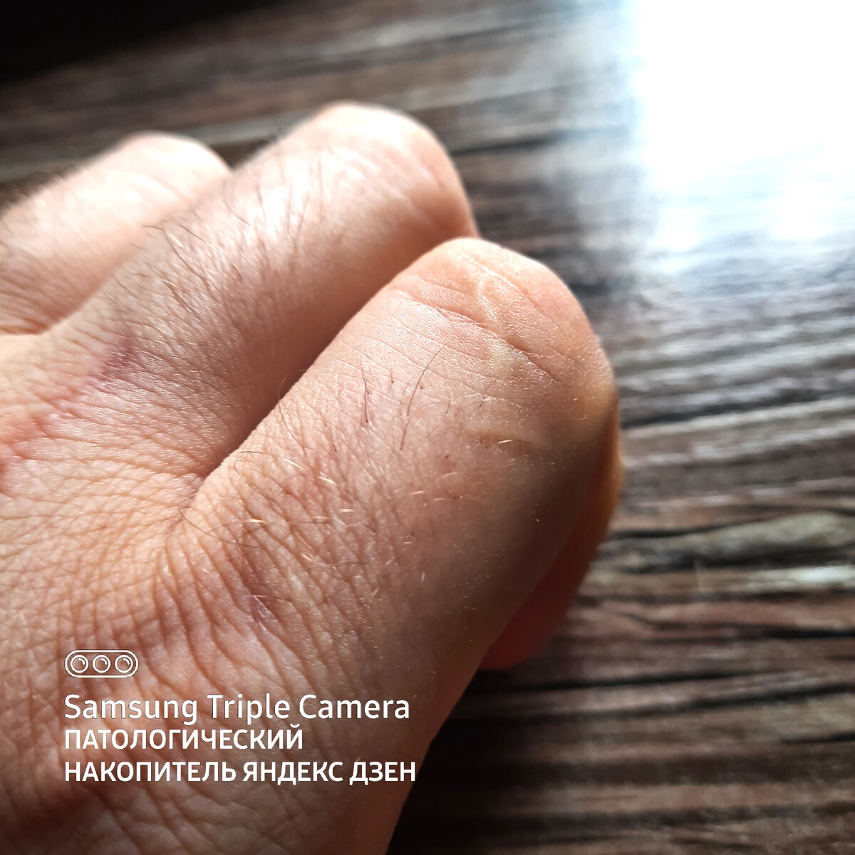 Отметины на указательном пальце.
