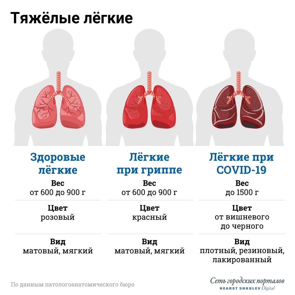 Что показывает рентген легких: как читать, что пишут в заключении