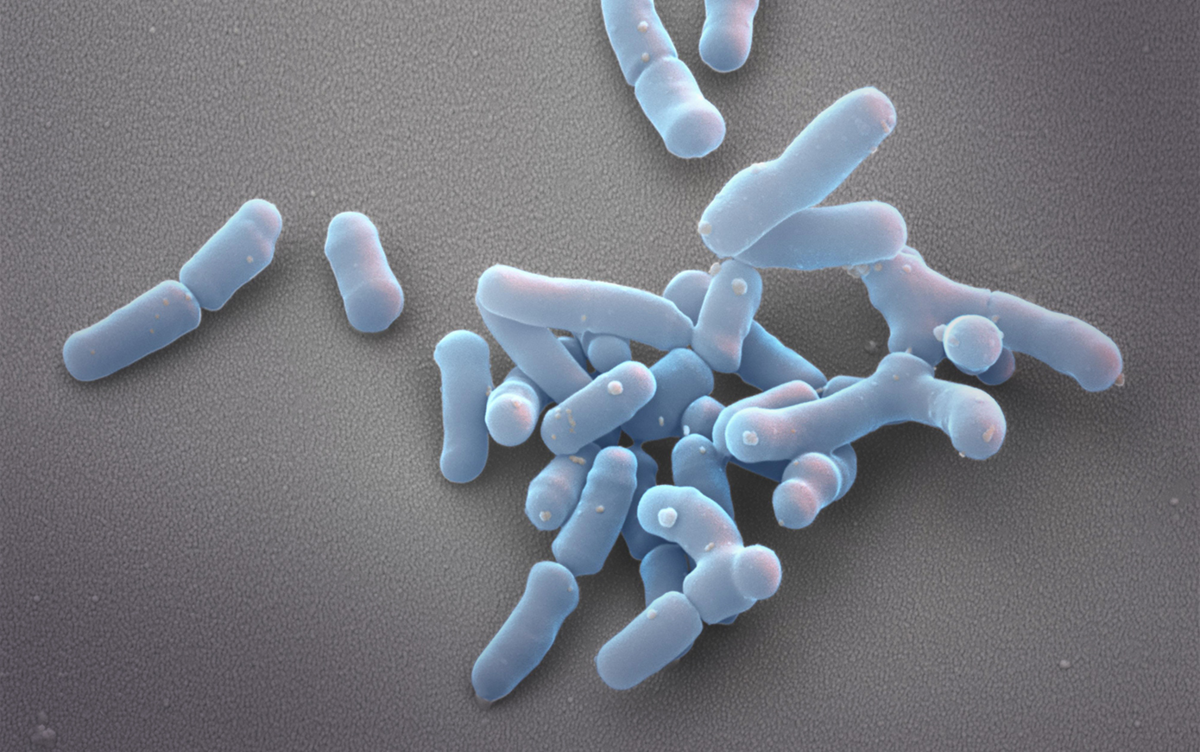 Lactobacillus. Бифидобактерии лонгум. Бифидобактерии ACTIREGULARIS. Bifidobacterium longum (на-135). Bifidobacterium bifidum.