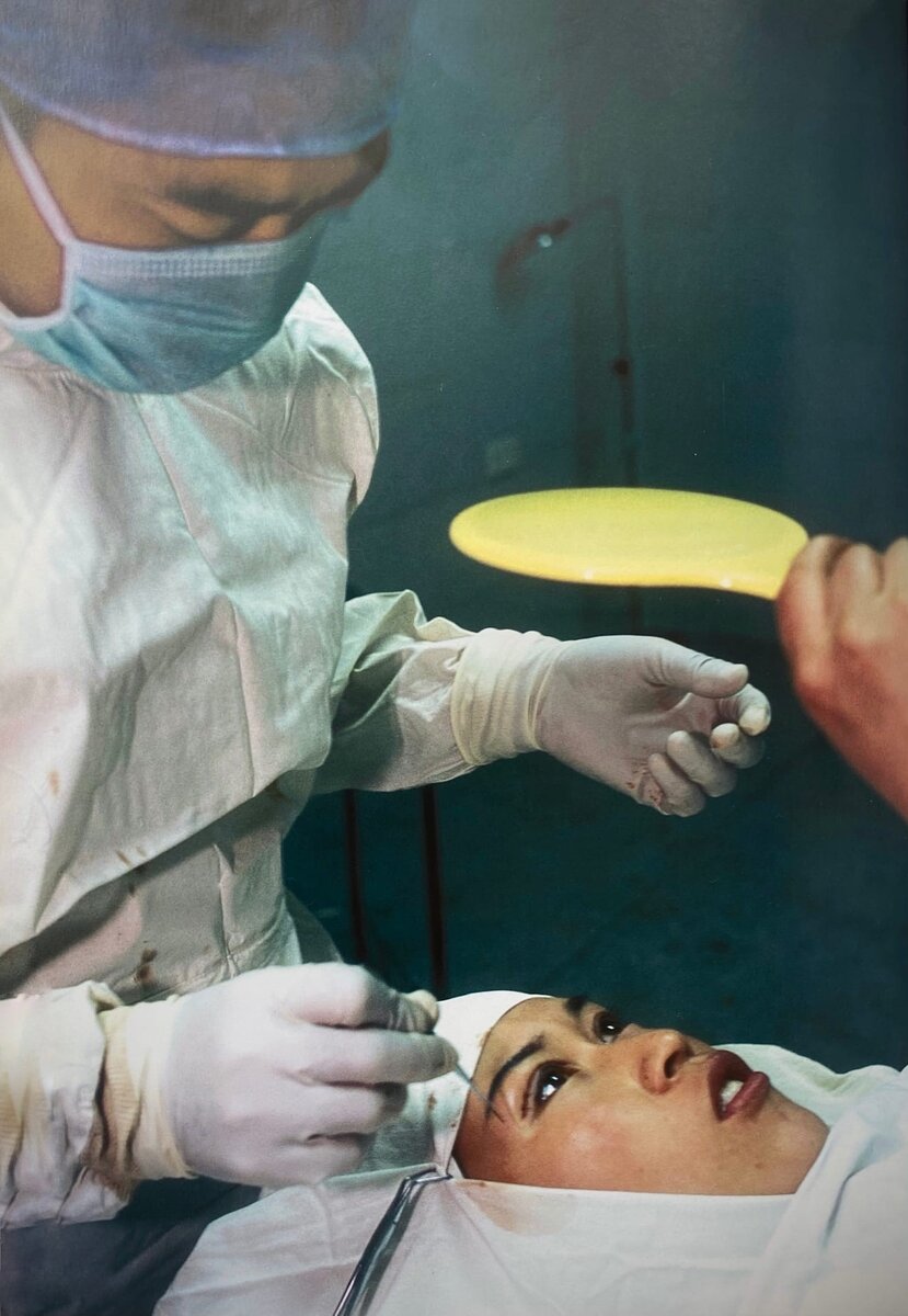 В Китае эра косметической хирургии началась сразу после смерти Мао Цзедуна в 1976 г.