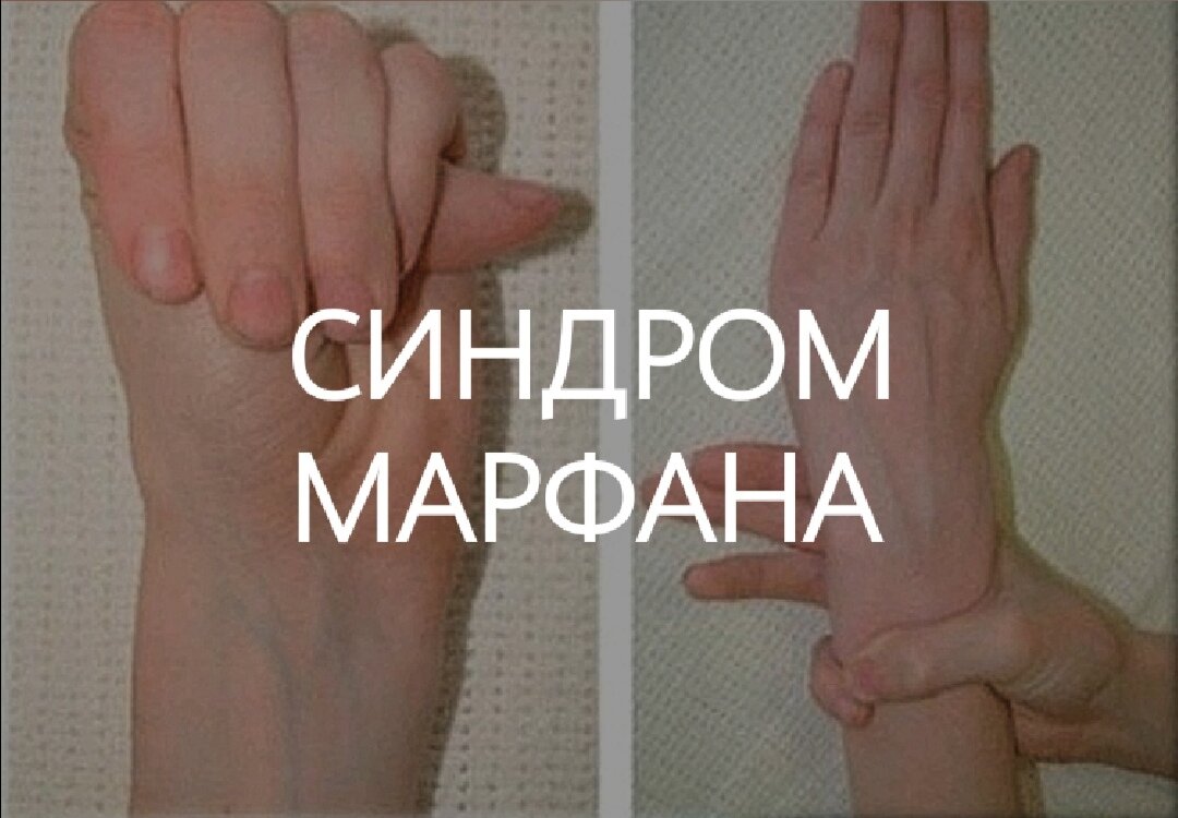 Удлиненные пальцы