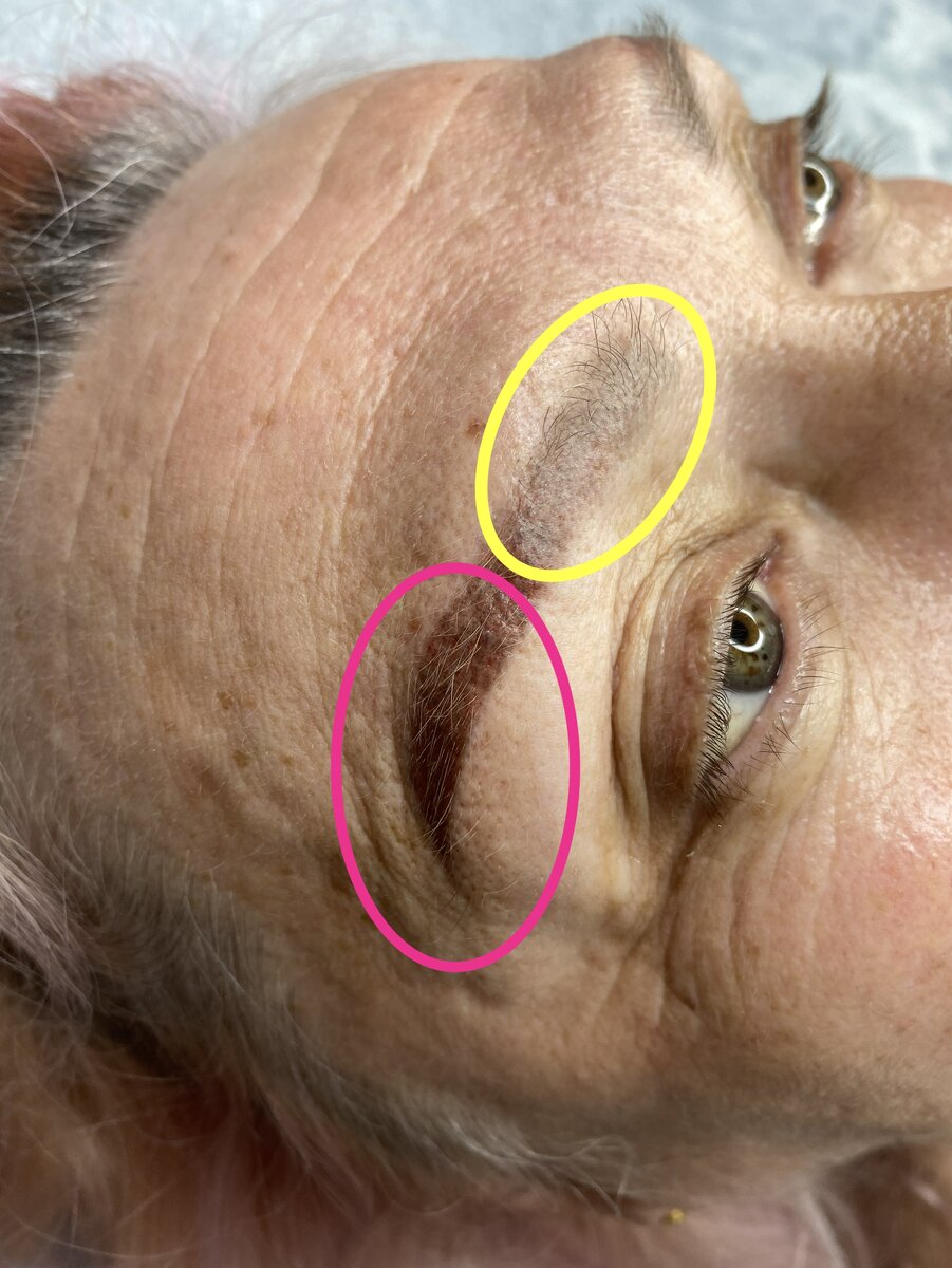 Фото В ПРОЦЕССЕ