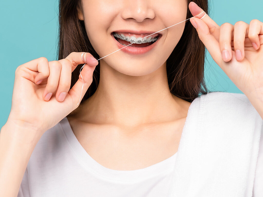 Комплексный подход в уходе за зубами и самодисциплина - залог успеха при ношении брекетов 