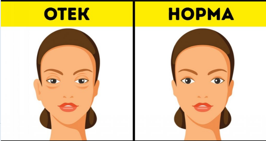 Взято из интернета