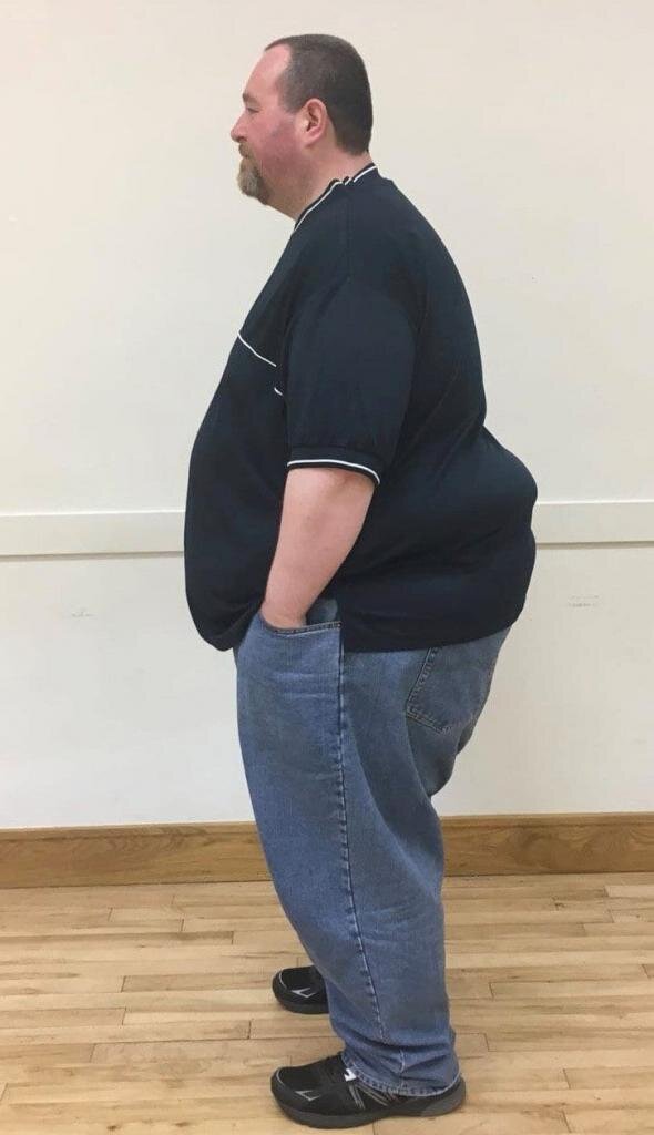 Мужчина снизил вес с 240 до 110 килограммов, когда узнал о болезни матери