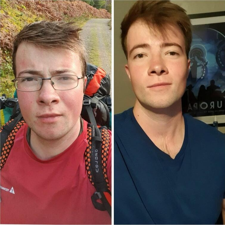 17 скинули. From before. Facial gains Reddit.
