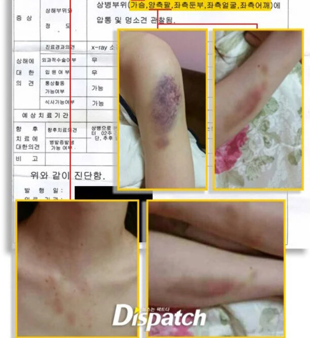 Побои мисс Чхве.