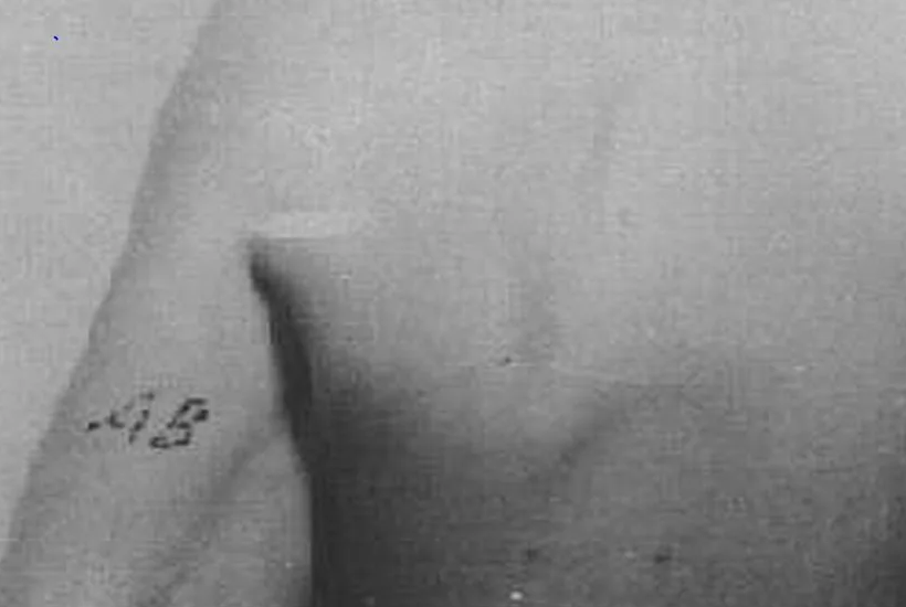 Необычные знаки на теле. Сатанинская звезда тату. Фото меток на теле. Родинки в виде созвездия. Знаки дьявола на теле человека.