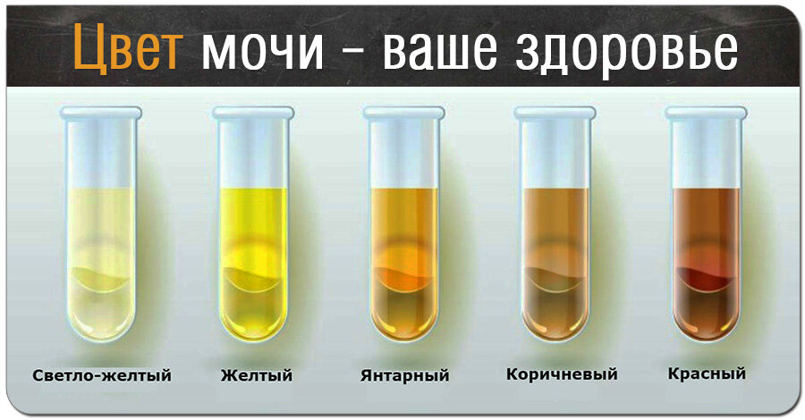 Почему изменяется цвет мочи