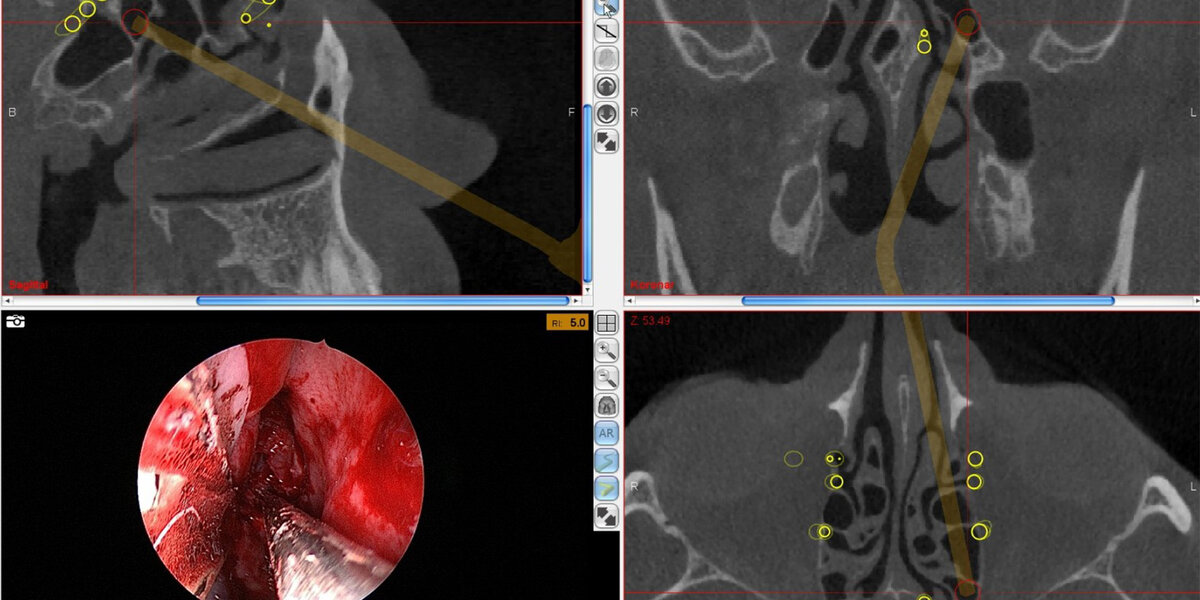Что нельзя делать после кт. Диета для пэт кт для исследования. Памятка перед пэт кт. Магнитно резонансная томография подготовка к исследованию. Протокол компьютерной томографии легких.