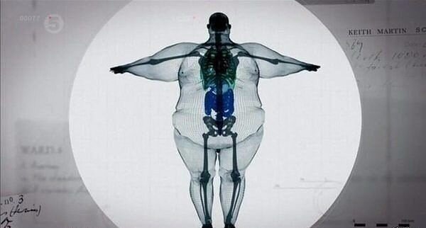 https://funnyjunk.com/Xray+of+800+pound+man/funny-pictures/5181204/