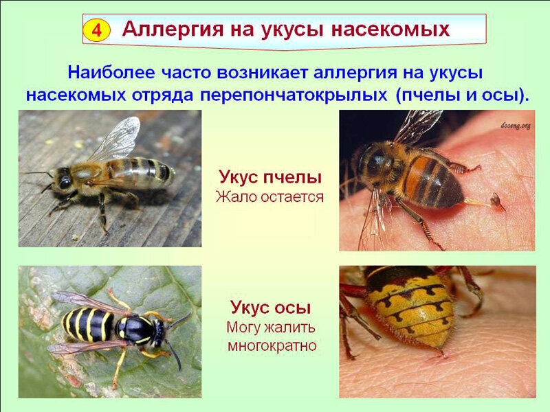Как выглядит аллергия на осу