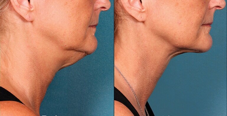 Фото из поисковой системы