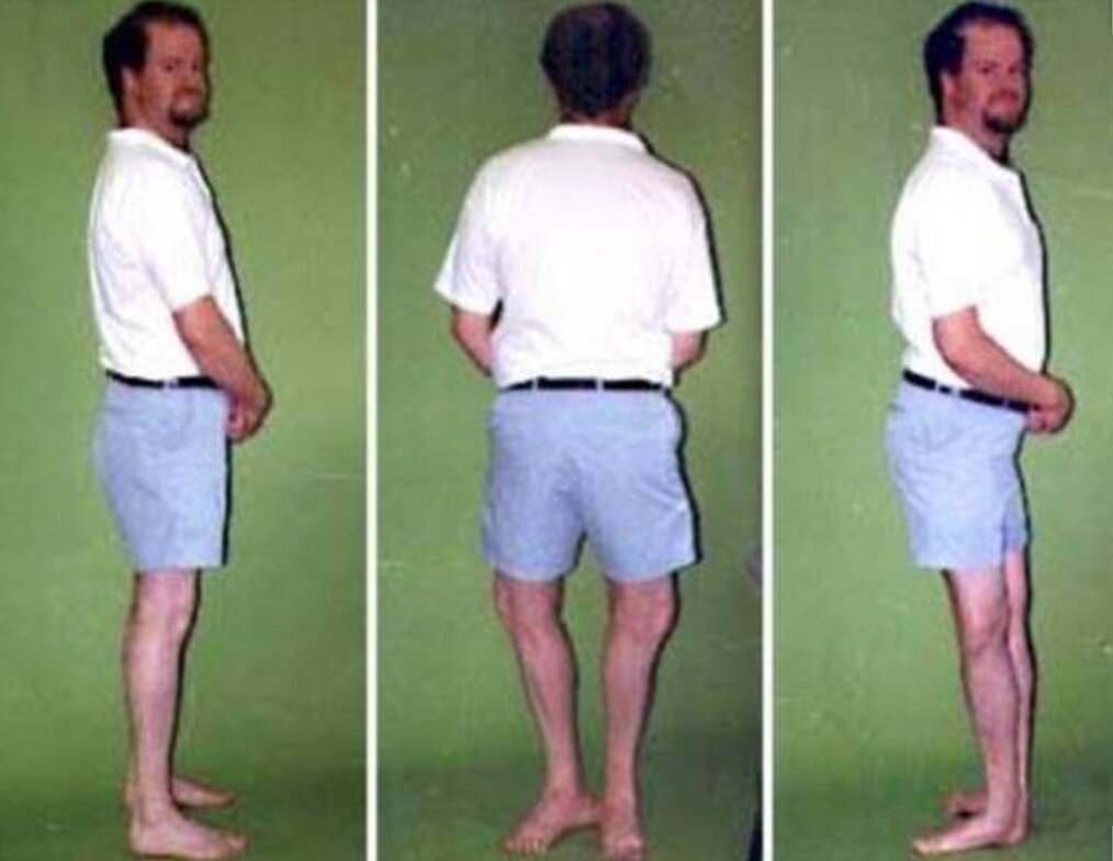 Мозес Ланхем