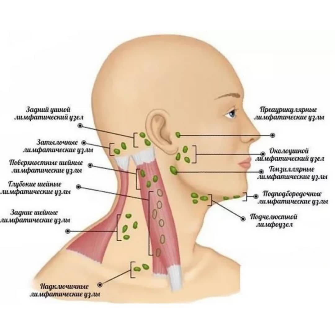 Расположение лимфоузлов на шее сзади схема. Нижнечелюстные лимфоузлы расположение. Схема расположения лимфатических узлов на шее. Заушные лимфатические узлы схема. Поверхностные шейные лимфатические узлы располагаются.