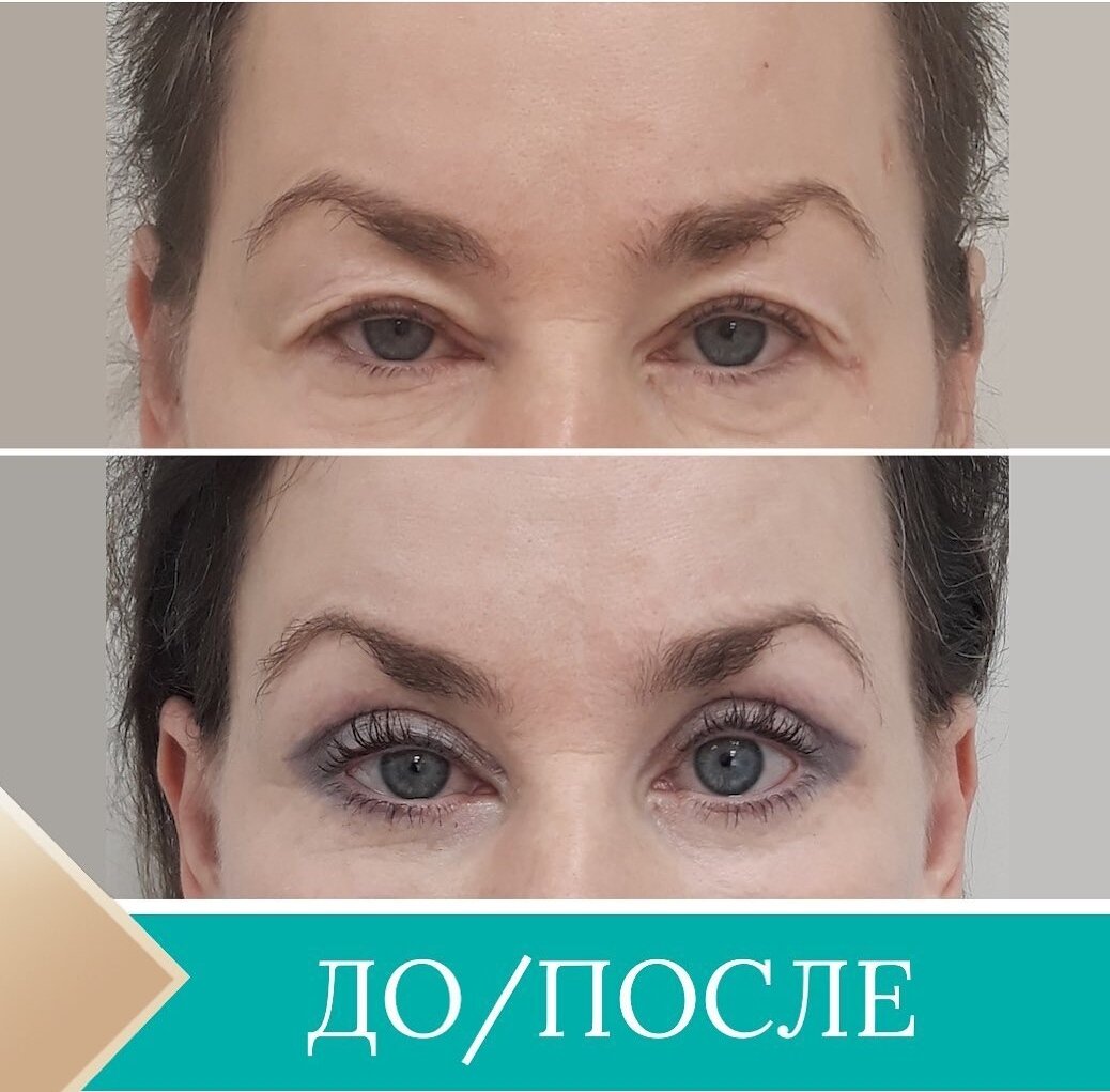 2. Физиологический раствор