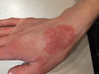 Качество цветов иногда вынужденно приходится тестировать на коже. Фото из личного архива собеседницы*