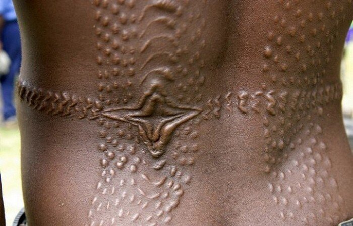 Из шрамов создаются сложные узоры, которые имитируют грубую кожу крокодила. Фото yandex.ru
