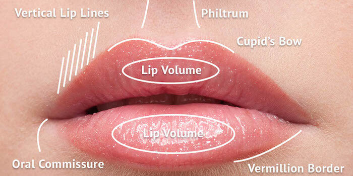 Увеличение губ: противопоказания и побочные эффекты от процедуры | Блог Gold Laser