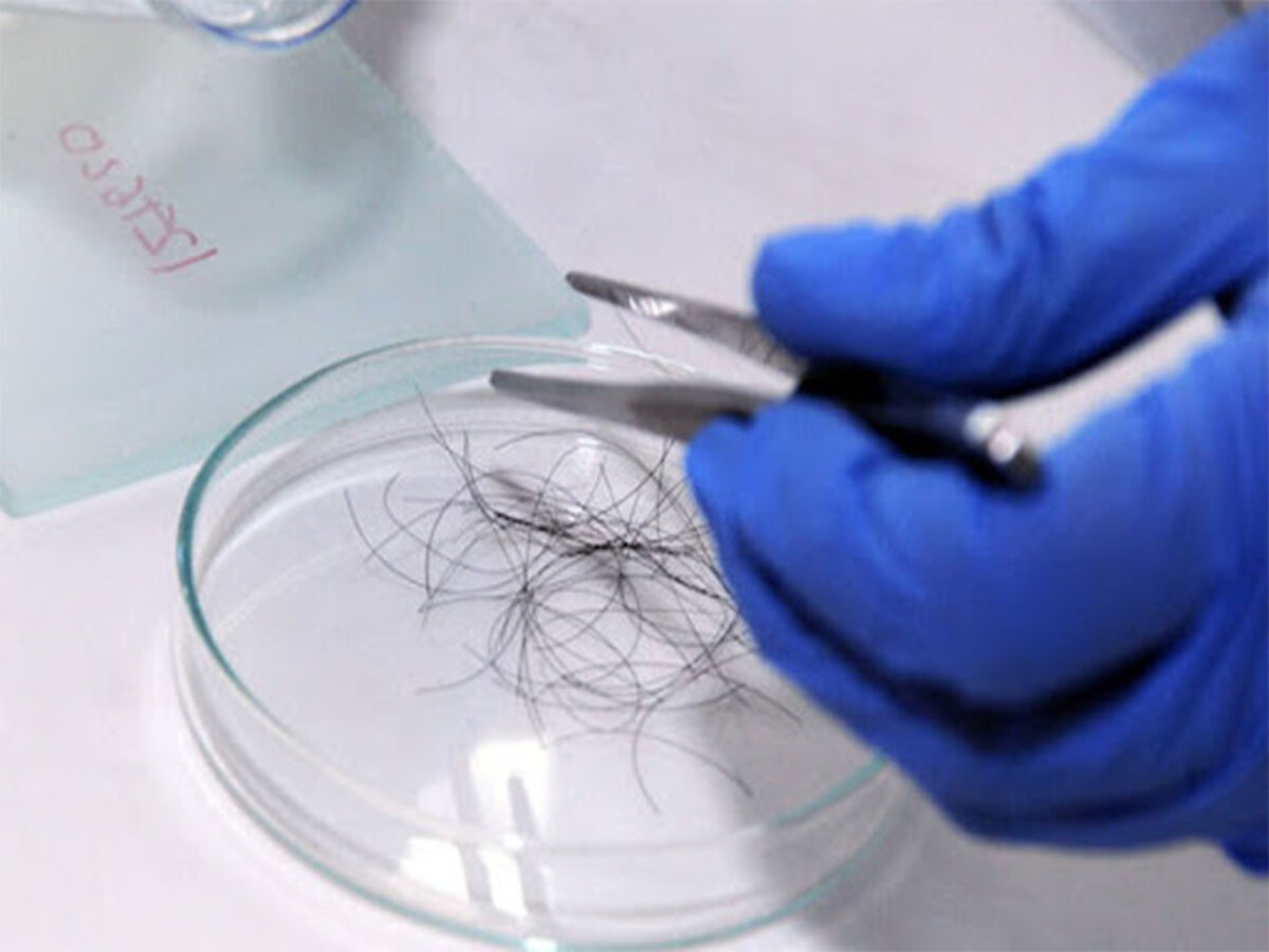 Волосы животных как объект судебно-биологической экспертизы