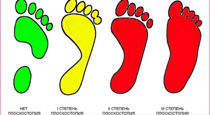 Намочите ноги и встаньте на бумагу, далее выберите подходящий рисунок.