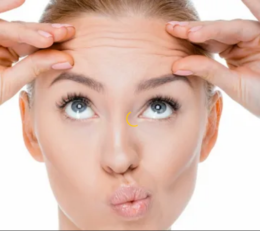 фото с сайта:https://lil-lab.ru/kak-ubrat-nosogubnye-morshhiny-disport-preparat-s-30-letnej-istoriej/