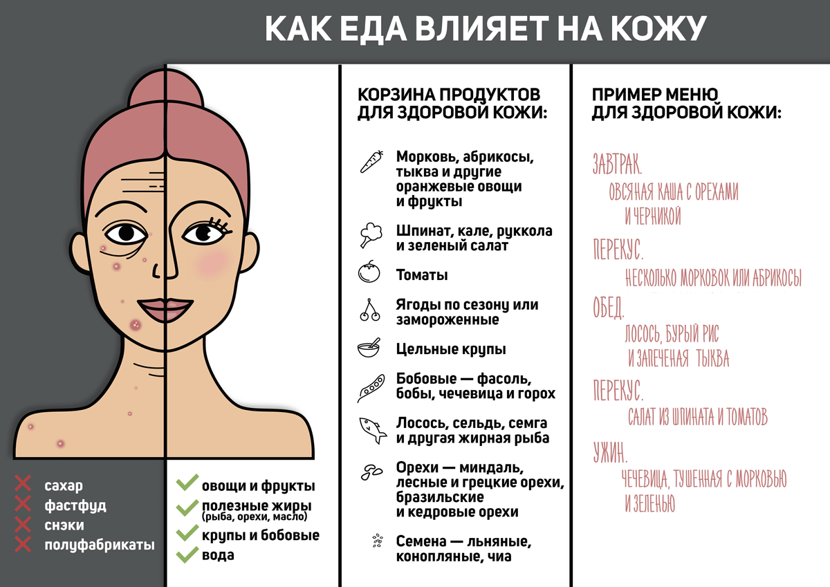 Прыщи на теле причины по зонам. Продукты для кожи лица. Продукты полезные для кожи. Продукты влияющие на прыщи. Продукты которые вызывают прыщи.