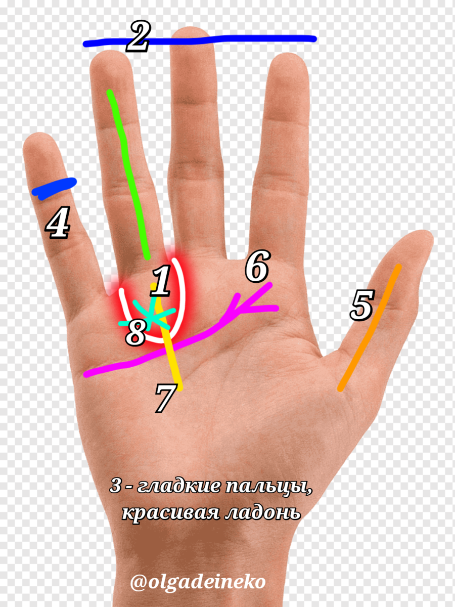 Хирологические признаки Аполлонианца. 