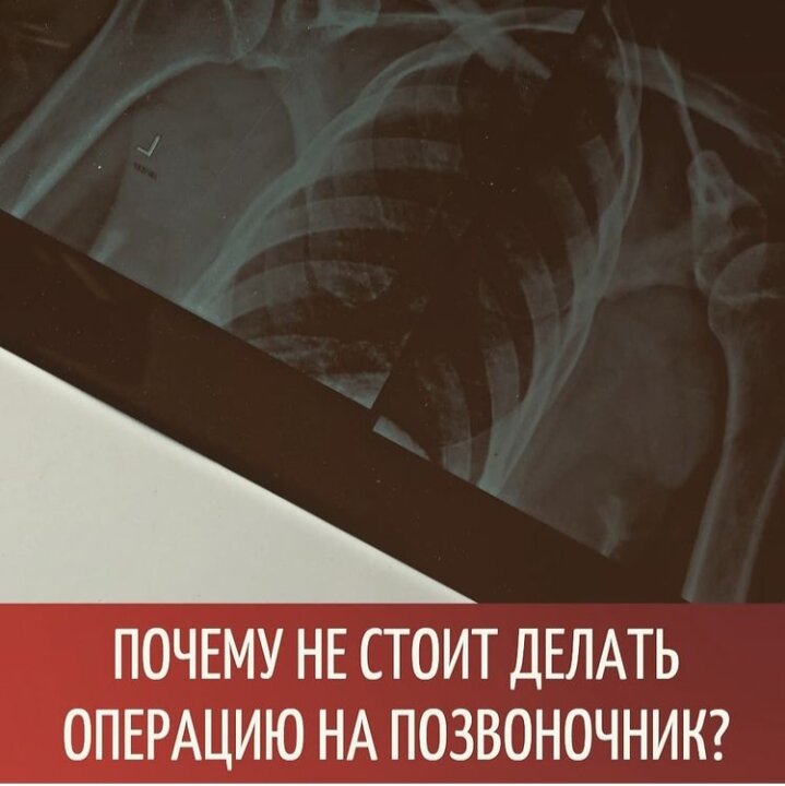 🤔Как-то один канадский #нейрохирург сказал, что из 100 % операций на позвоночник, необходимость имеют только 2%.