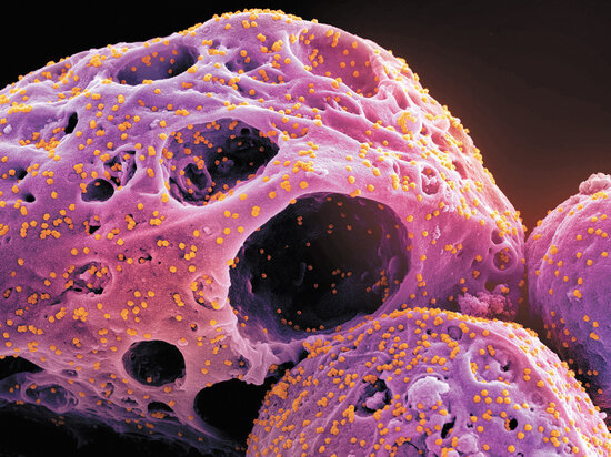     «Кракен» под микроскопом. / AP