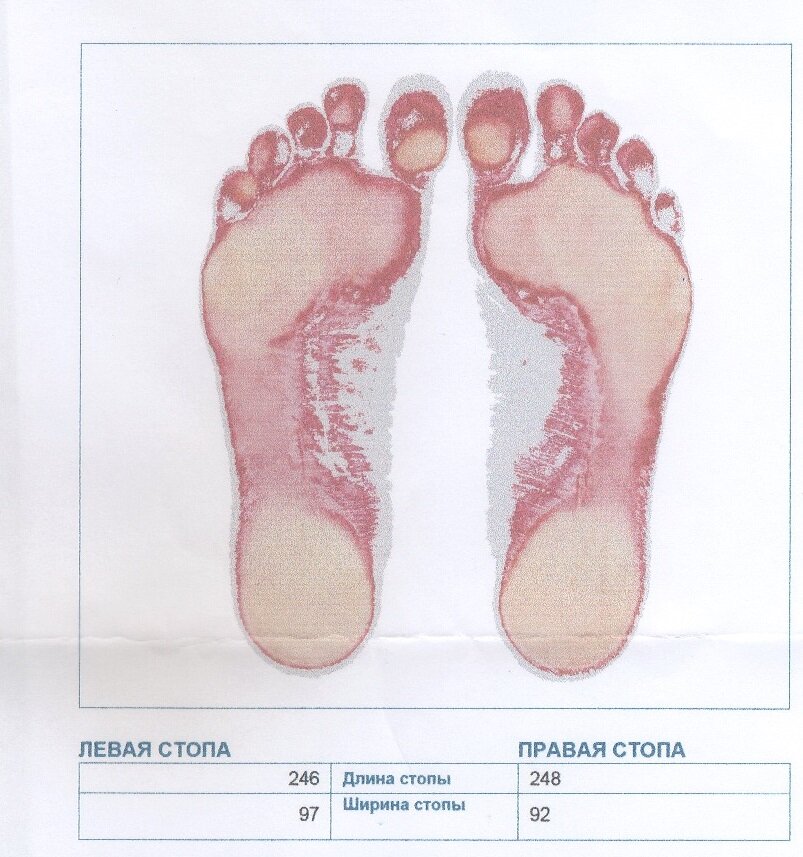 По результатам пройденного обследования ортопед мне сделал распечатку результатов, на котором изображены проекции моих стоп, указаны их параметры (ширина и длина)
