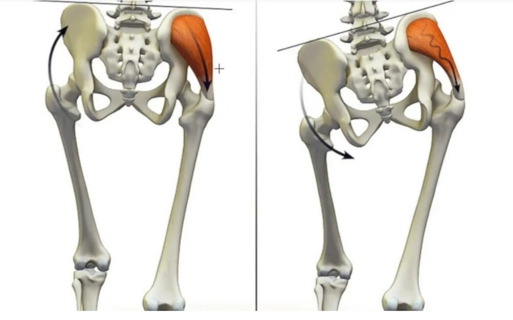 Нормальный таз и перекошенный