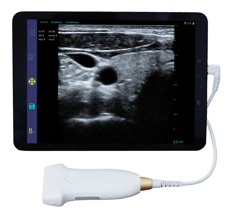 УЗИ зонд. Фото hiprove.com