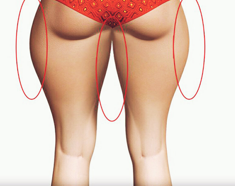 Проблемные зоны.