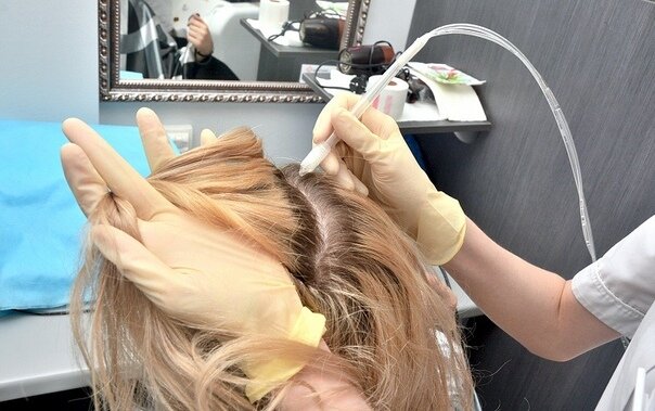 Процедура газо-жидкостного пилинга кожи головы