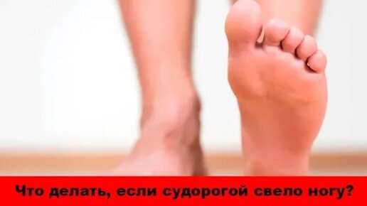 Download Video: Судорогой свело ногу - что делать? 10 советов как снять или предупредить судороги ног