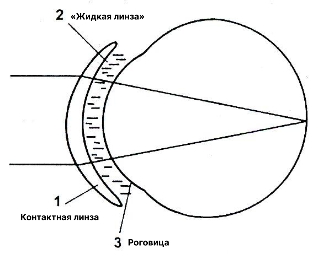 Схема преломления луча контактной линзой и глазом. Источник: С. Н. Михайлова «Технология изготовления контактных и интраокулярных линз». Методическое пособие.