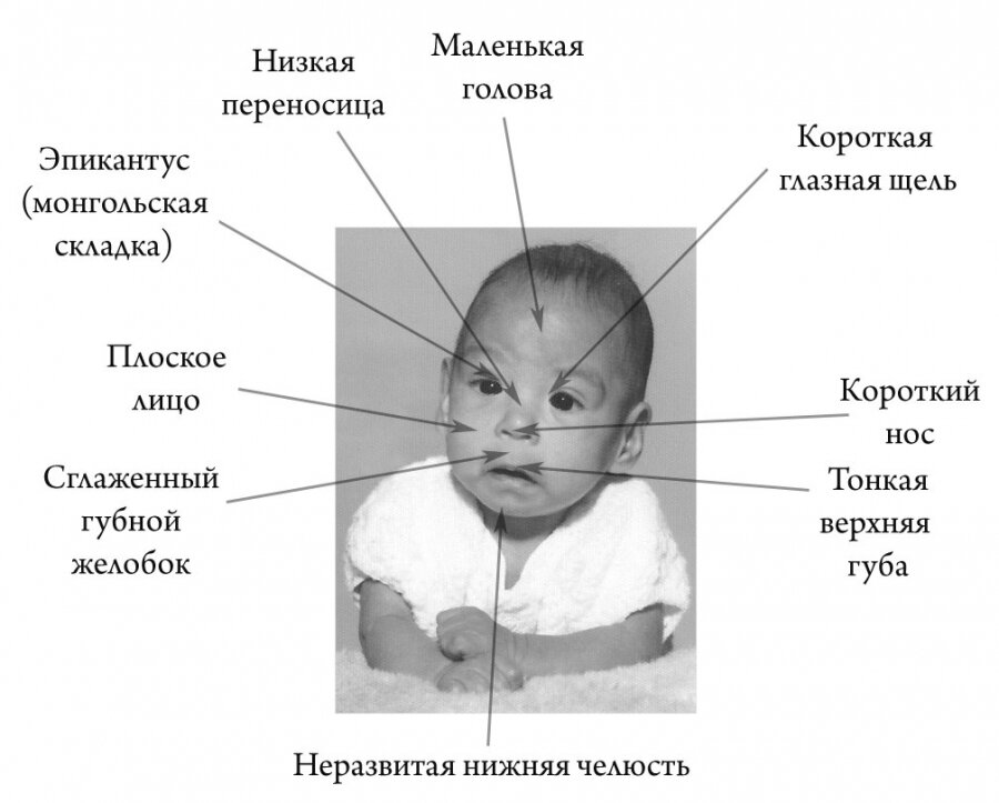 Как нас убивает алкоголь? 15 причин задуматься