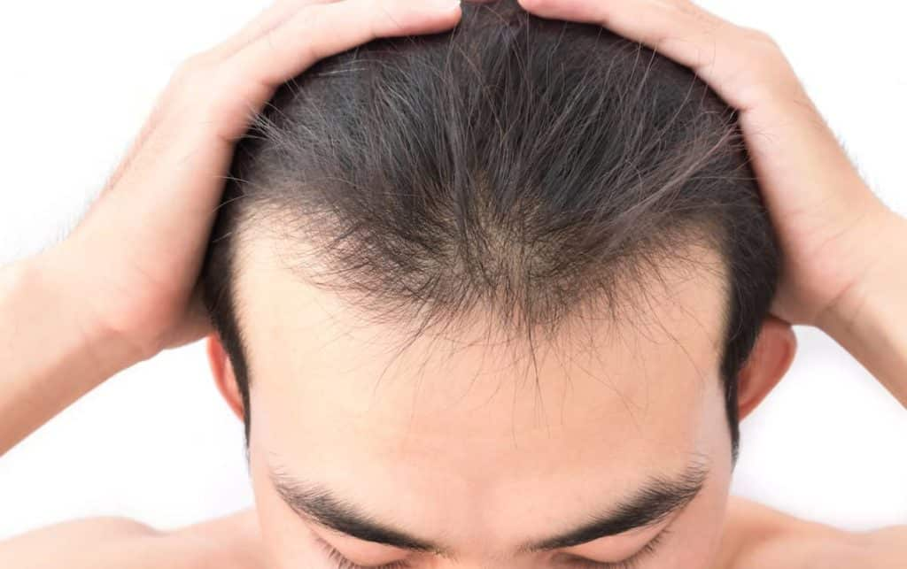 От простатита волосы могут выпадать волосы