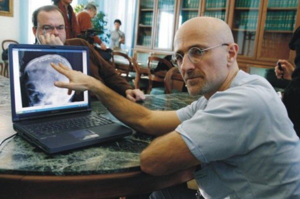 Хирург Серджо Канаверо, автор проекта по пересадке головы