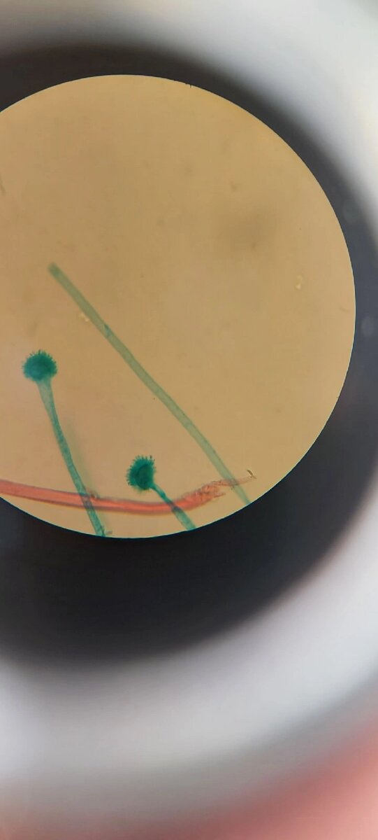 Созревшая гифа Мукора под микроскопом