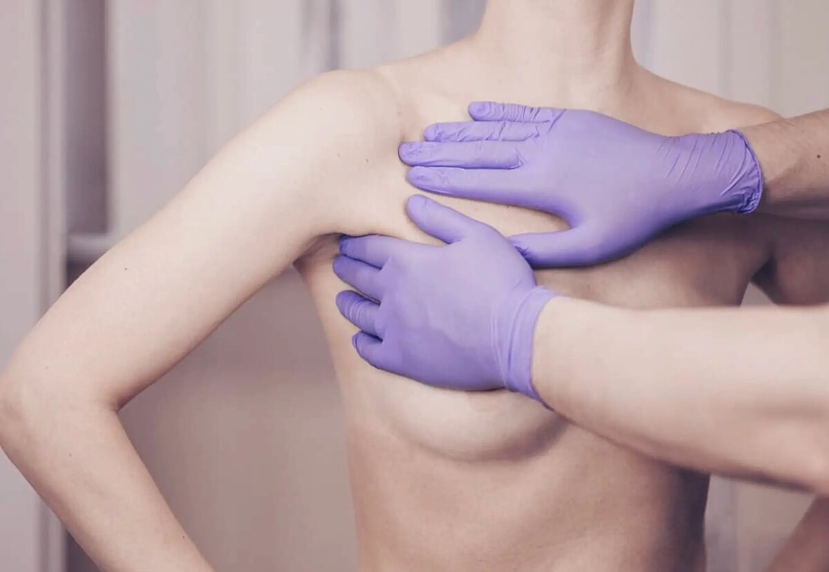 маммолог это какой врач