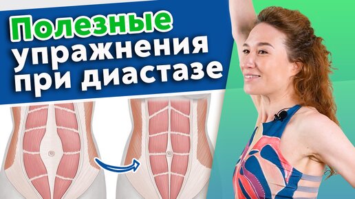 Descargar video: Как убрать диастаз в домашних условиях? 5 упражнений для избавления от диастаза.